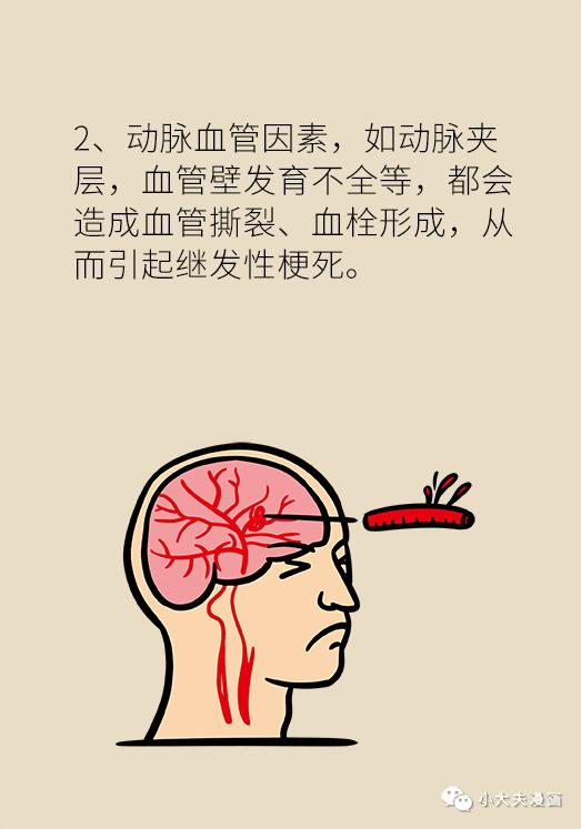 体检预防脑梗,卒中预防的三个基本方法