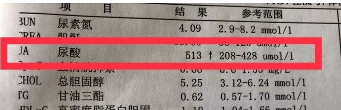 高尿酸血症降尿酸治疗最新指南,80%尿酸是人体产生的