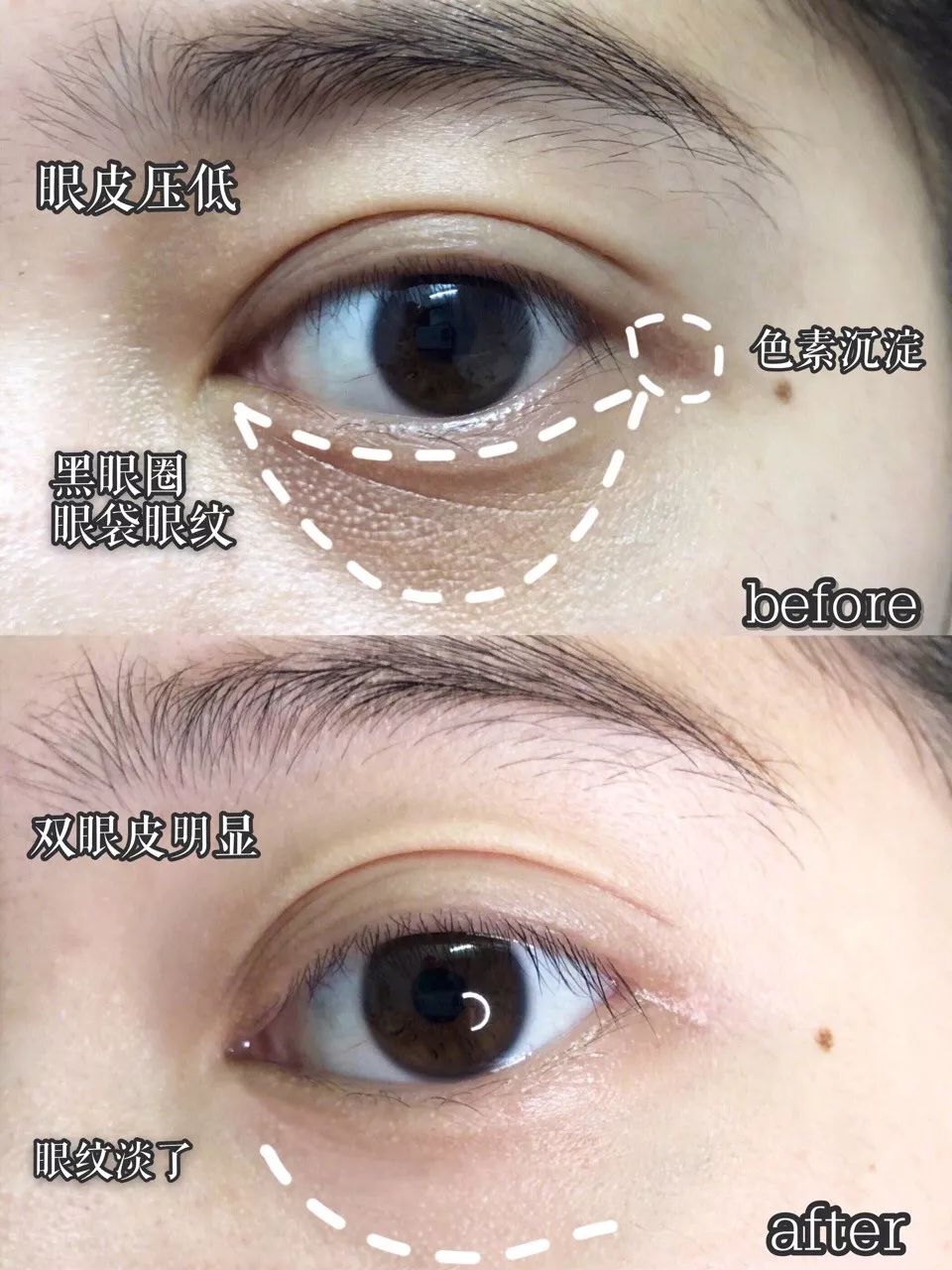 韩国品牌眼霜补水保湿,推荐一款韩国好用的眼霜