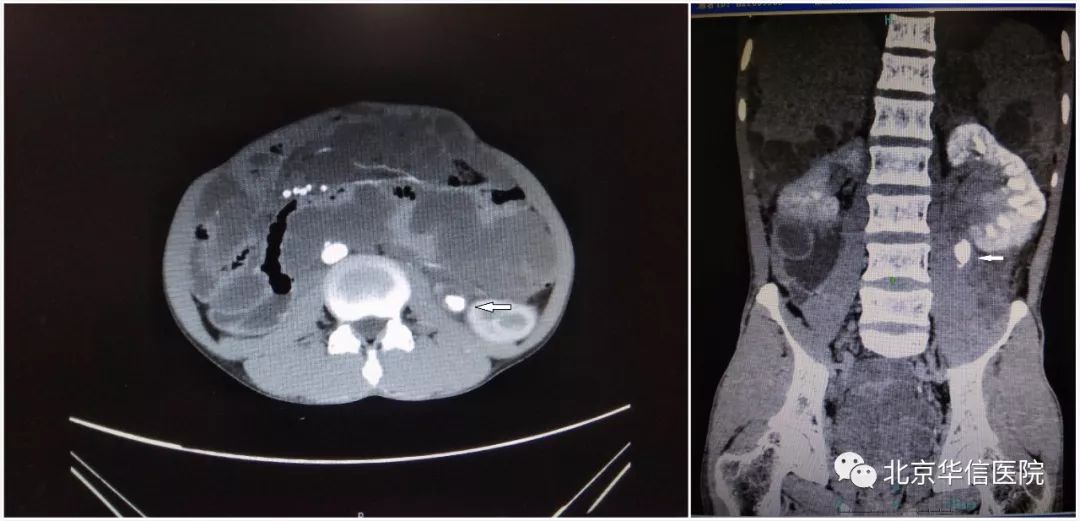 小通道解决大问题——清华大学第一附属医院“水利工程师”为患者解除病痛