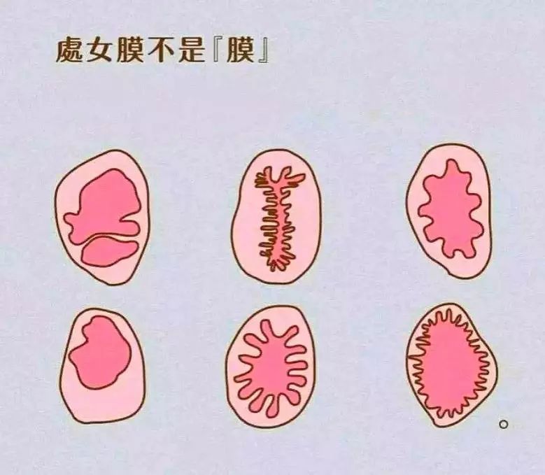 「女科荟」大部分人都错了——处女膜其实不是膜!