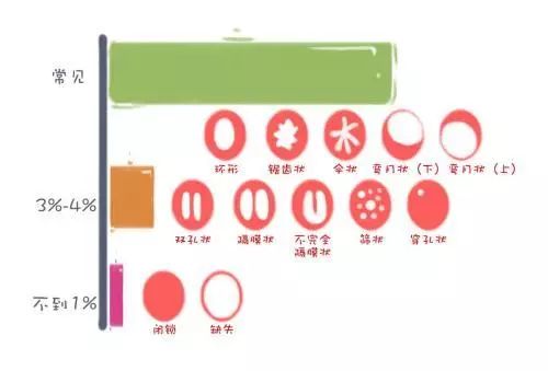 「女科荟」大部分人都错了——处女膜其实不是膜！