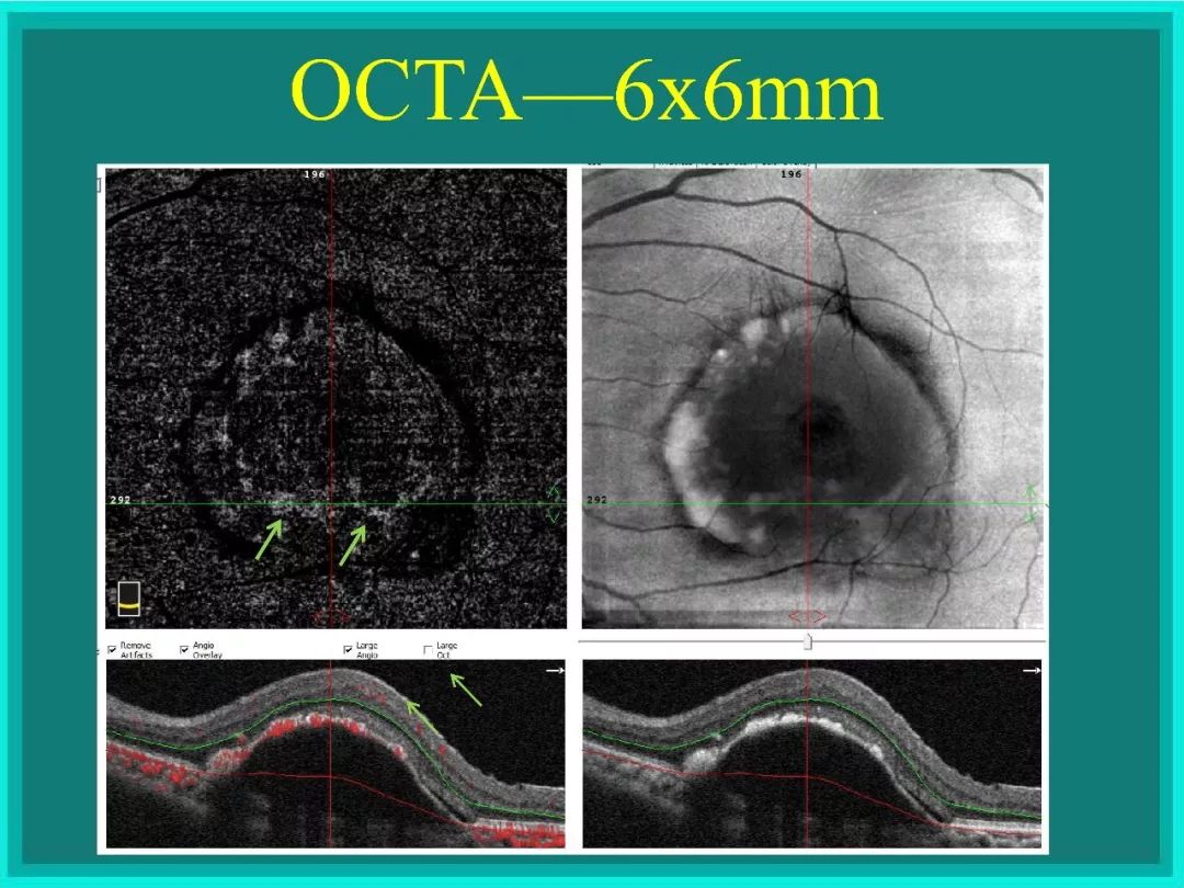 明者远见于未萌原文,明者远见于未萌解释