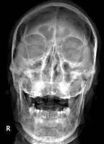 鍕囬棷鐢熷懡绂佸尯鍖婚櫌,鍕囬棷鐢熷懡绂佸尯浜旀鍙仠鎵嬫湳