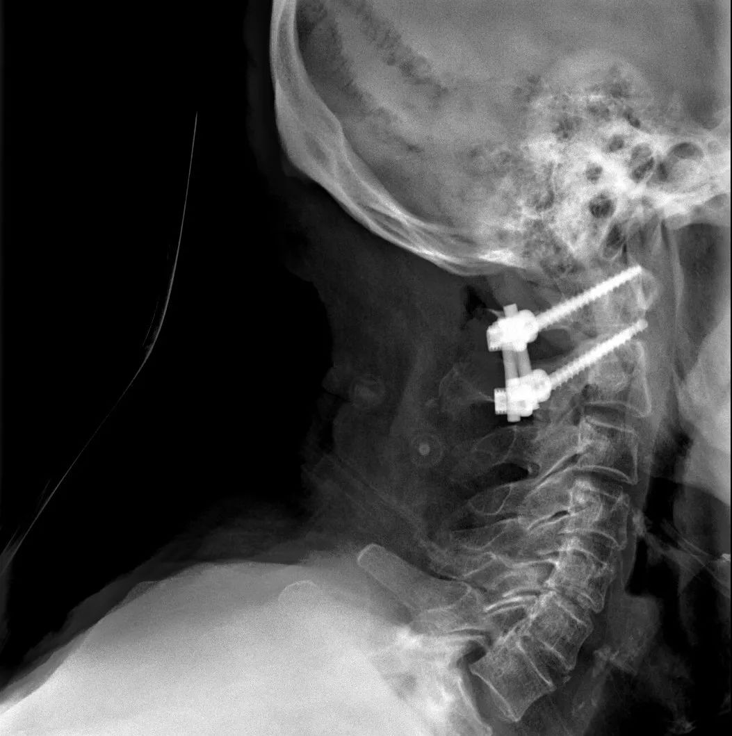 鍕囬棷鐢熷懡绂佸尯鍖婚櫌,鍕囬棷鐢熷懡绂佸尯浜旀鍙仠鎵嬫湳