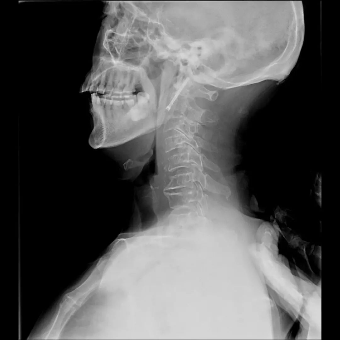 鍕囬棷鐢熷懡绂佸尯鍖婚櫌,鍕囬棷鐢熷懡绂佸尯浜旀鍙仠鎵嬫湳