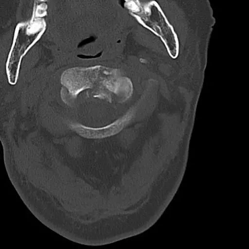 鍕囬棷鐢熷懡绂佸尯鍖婚櫌,鍕囬棷鐢熷懡绂佸尯浜旀鍙仠鎵嬫湳
