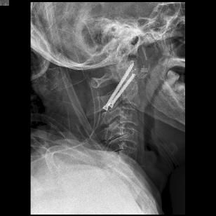 鍕囬棷鐢熷懡绂佸尯鍖婚櫌,鍕囬棷鐢熷懡绂佸尯浜旀鍙仠鎵嬫湳