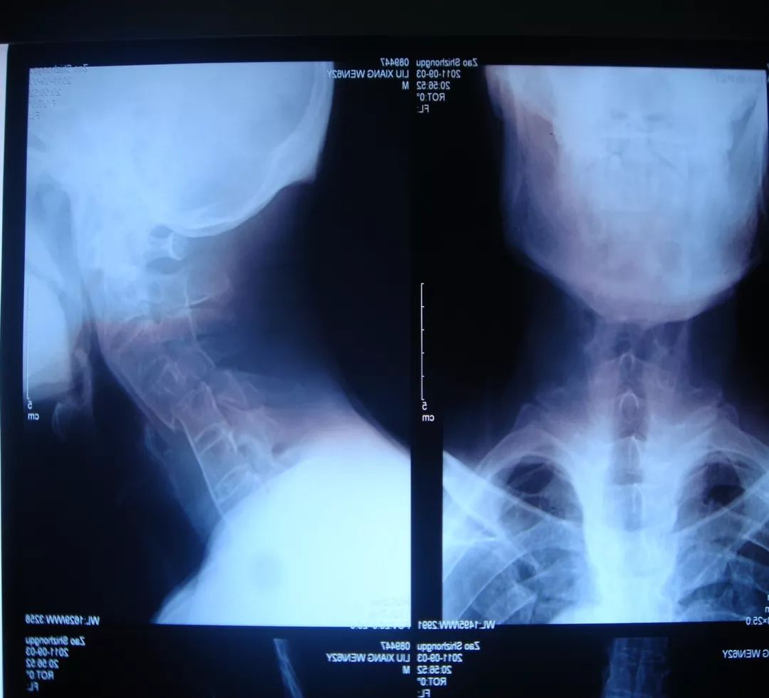 鍕囬棷鐢熷懡绂佸尯鍖婚櫌,鍕囬棷鐢熷懡绂佸尯浜旀鍙仠鎵嬫湳