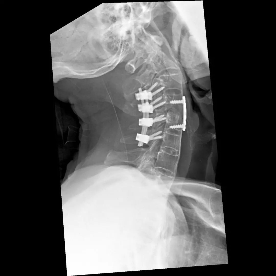 鍕囬棷鐢熷懡绂佸尯鍖婚櫌,鍕囬棷鐢熷懡绂佸尯浜旀鍙仠鎵嬫湳