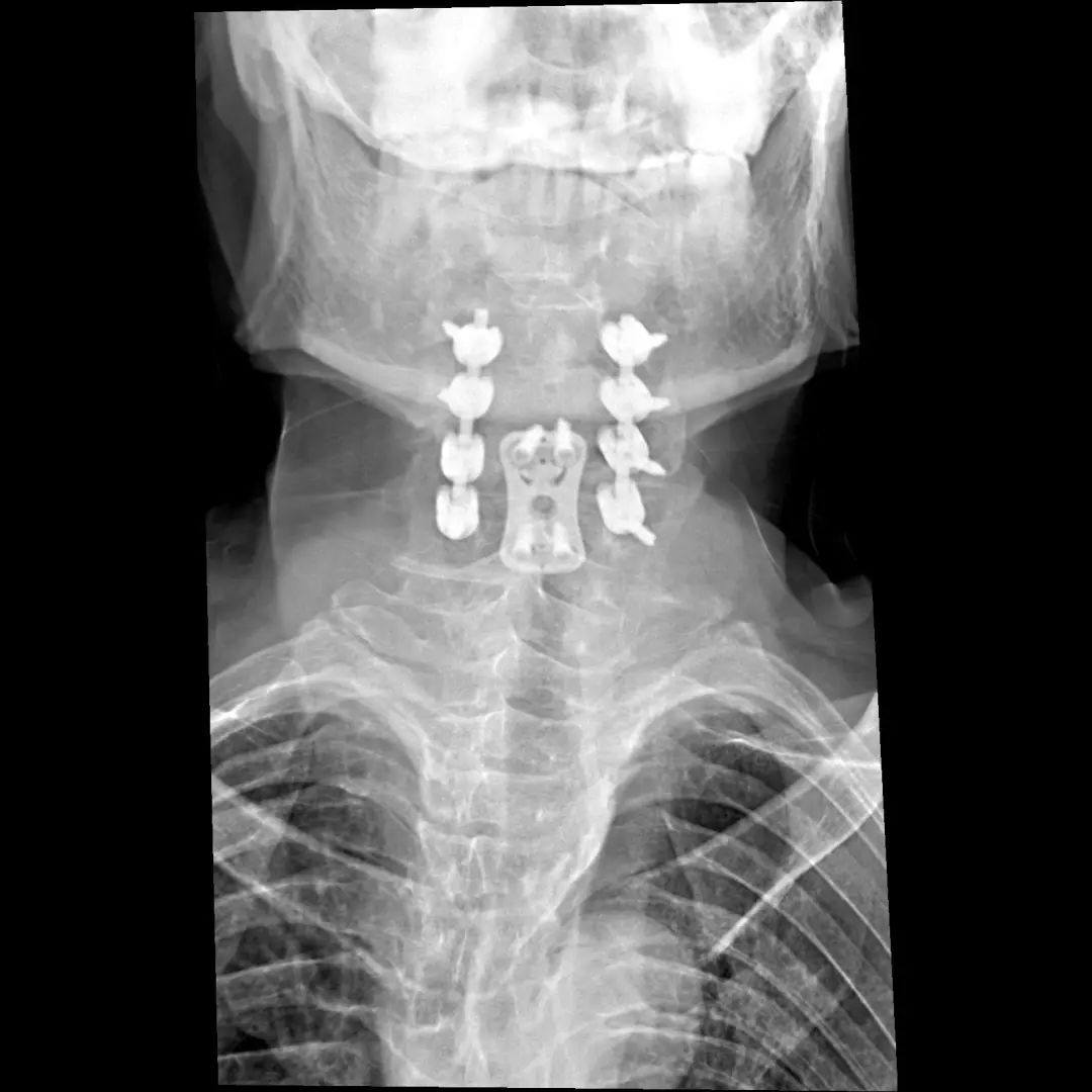 鍕囬棷鐢熷懡绂佸尯鍖婚櫌,鍕囬棷鐢熷懡绂佸尯浜旀鍙仠鎵嬫湳