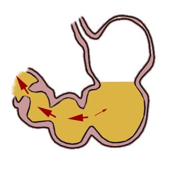 「快点医讯」家门口的福音:温州市消化道早癌筛查版图扩展!