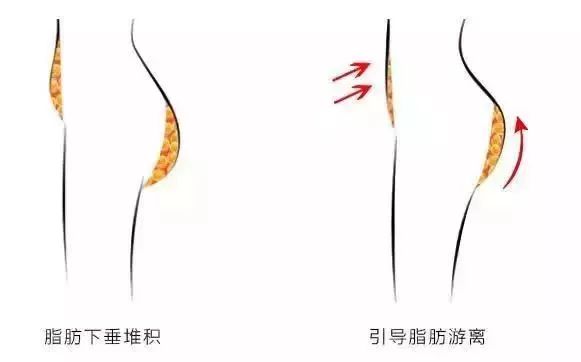 女性的妇科疾病70%和卫生巾有关,80%的女性都有妇科炎症对吗