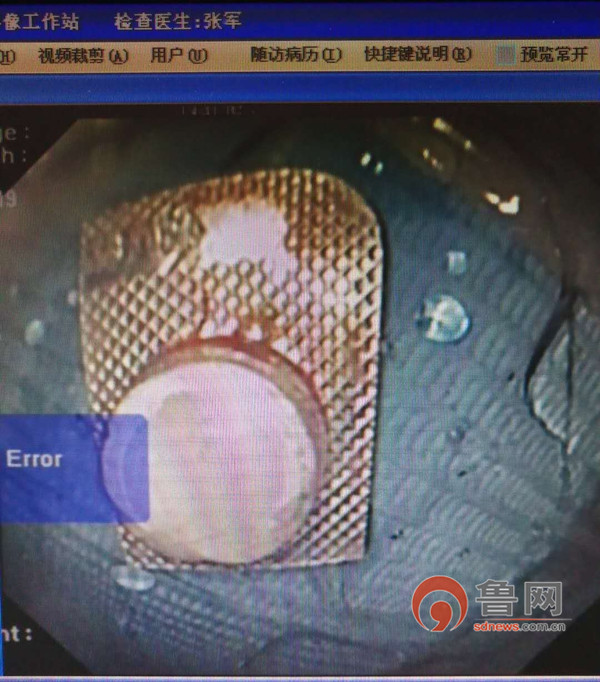 平度第三人民医院,平度第三人民医院医生会做手术吗