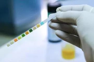 「科普」体检、化验，留取尿样有讲究，否则……