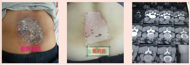 送温暖送医生活动,岭南中医名医馆