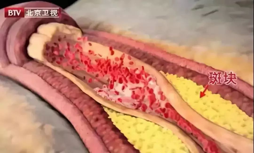 饼干查出有致癌物大家还敢吃吗,饼干致癌真相揭秘