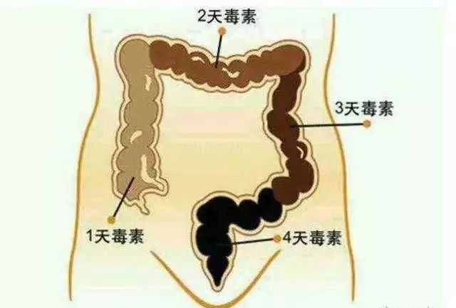 万病始于肠！每天1杯，轻松排肠毒，便秘、口臭、肚腩都没了！