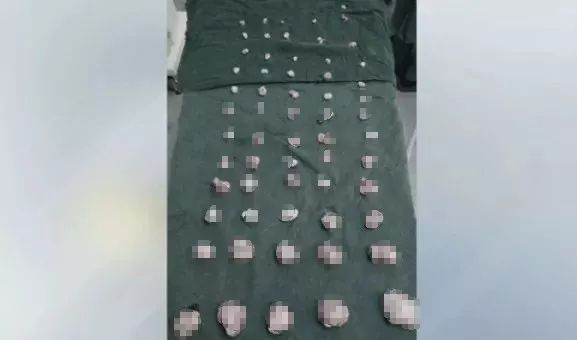 被“它”折磨的女性越来越多！医生看到她子宫里的东西——彻底惊呆了！