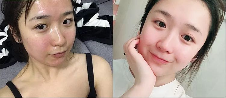 南非春夏复活草保湿水,南非不死草对皮肤的好处