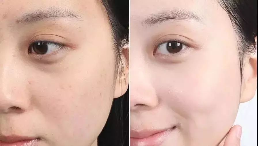 南非春夏复活草保湿水,南非不死草对皮肤的好处