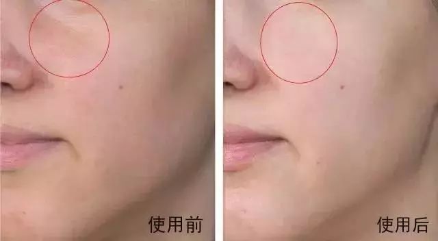 南非春夏复活草保湿水,南非不死草对皮肤的好处