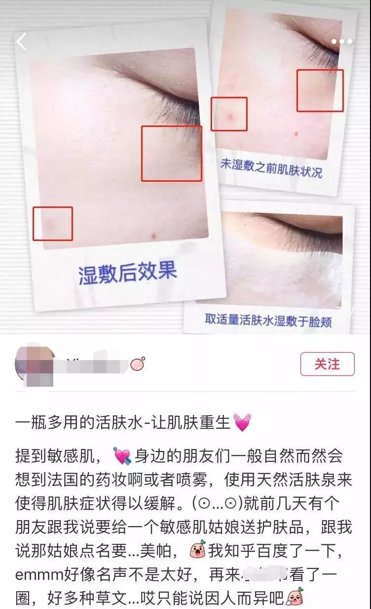 南非春夏复活草保湿水,南非不死草对皮肤的好处