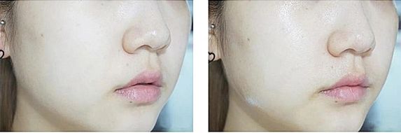 胶原蛋白吃的好还是涂的效果好,胶原蛋白是吃进去好还是脸部抹好