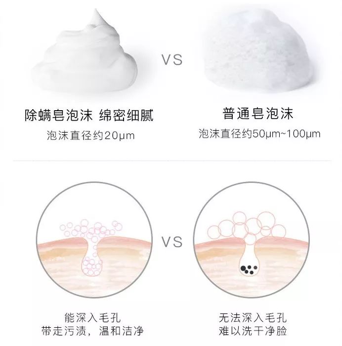 脸上螨虫黑头用完除螨皂好了,脸上有螨虫防螨皂