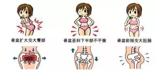 女人骨盆移位怎么办,女性骨盆倾斜怎么治疗