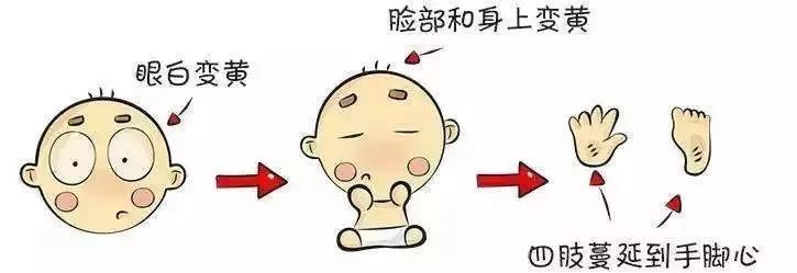 痛心!中山这位医生发圈:无知母亲致黄疸儿重度脑瘫!智商为0