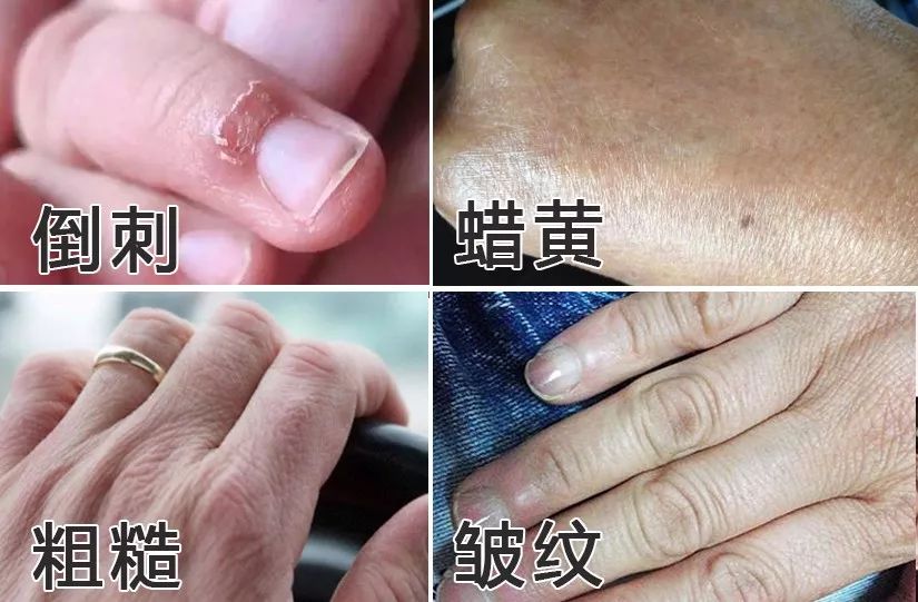 一天洗无数次手，记得要这么做