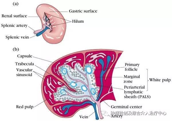 脾动脉栓塞术,脾栓塞手术的适应症