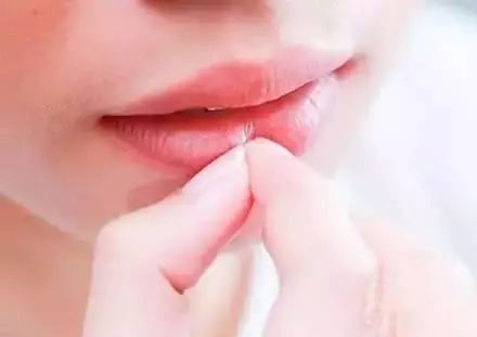 几块钱一瓶的维生素B2，横扫这些疾病！为家人收藏