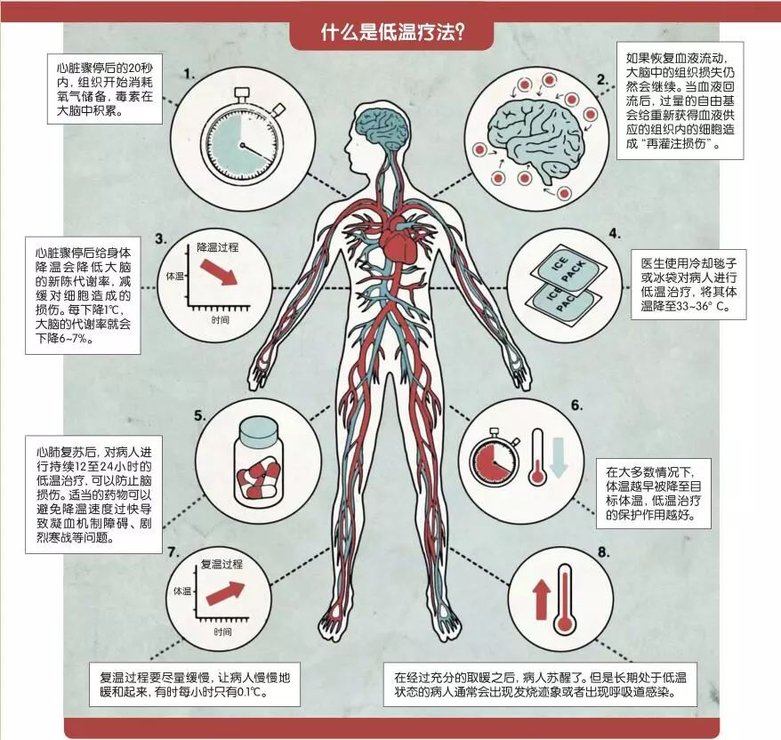 低温疗法:突破生死界限