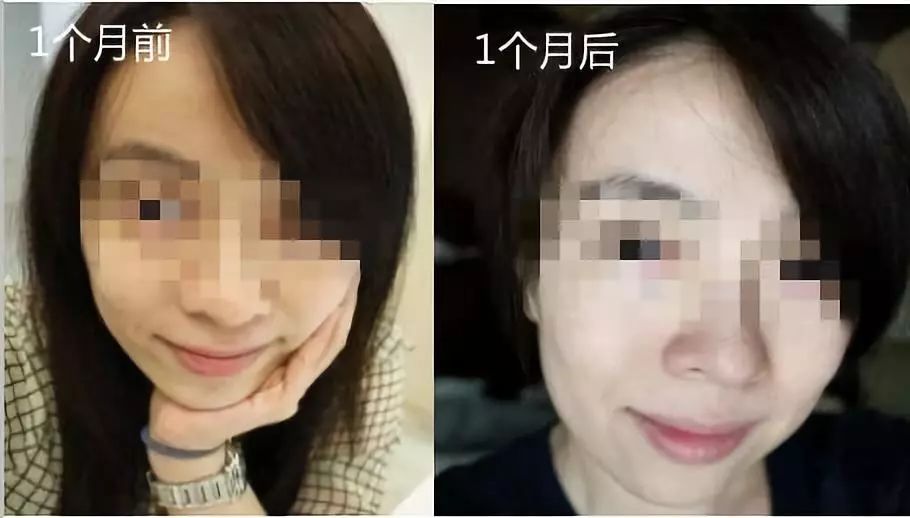 美白针可以10天打一次吗,可以美白的针