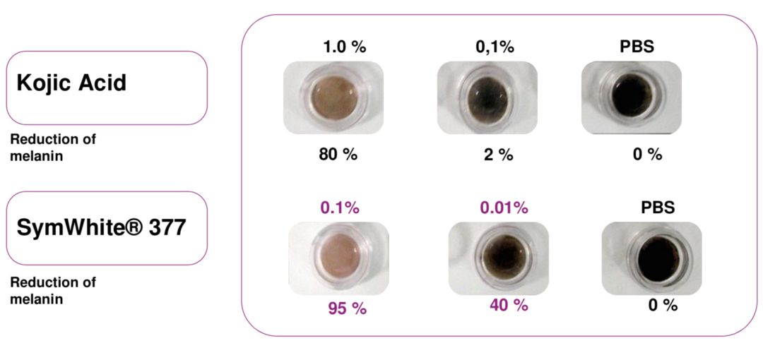 美白针可以10天打一次吗,可以美白的针