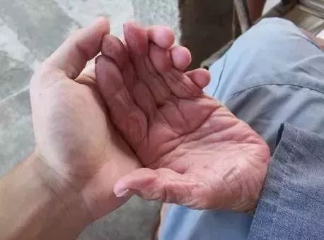 白衣脏洗不掉怎么办,衣领上的皮肤油渍用什么洗效果好