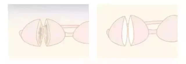 白衣脏洗不掉怎么办,衣领上的皮肤油渍用什么洗效果好