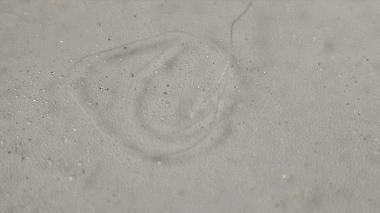 6d线雕提拉童颜术,不打针不开刀祛皱纹的轻医美