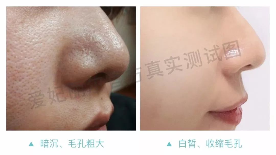 娱乐圈年近50岁不老的秘密曝光,原来只是做好了这一点!