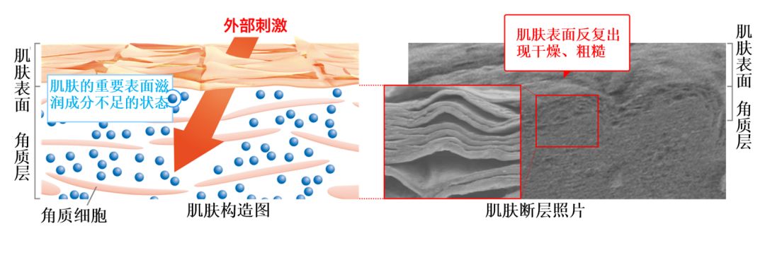 秘籍｜入春换季，生活不易，敏感肌不叹气