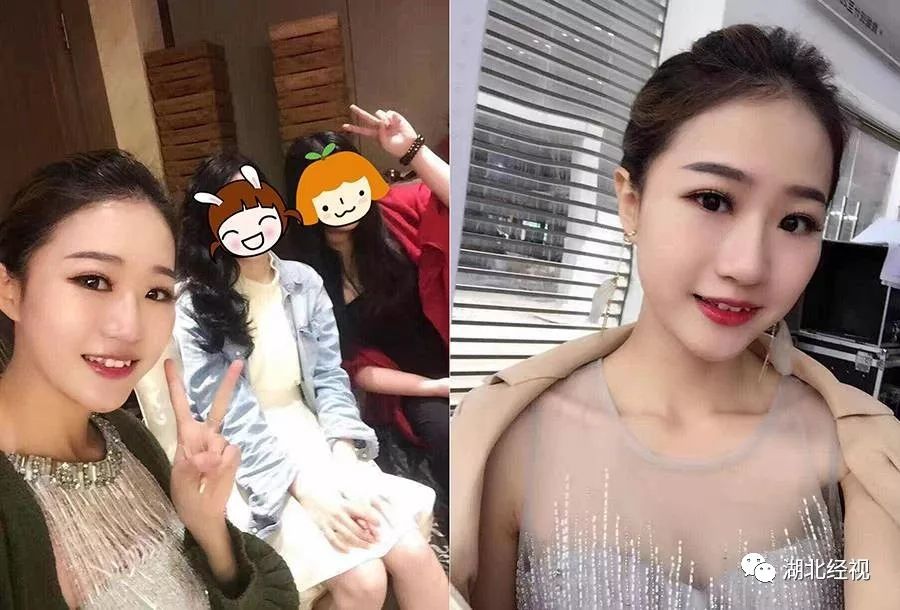 推广|身份证42开头的注意!牙齿矫正、种植牙,这些全免费!