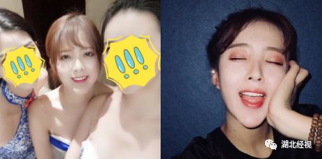 推广|身份证42开头的注意!牙齿矫正、种植牙,这些全免费!