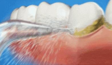 刚刷完牙有必要用漱口水吗,刷完牙有必要用漱口水么