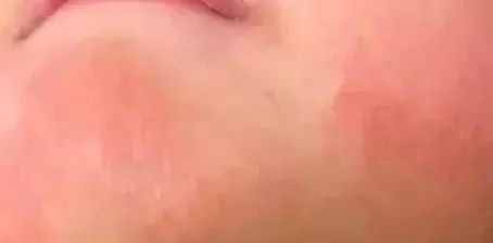 宝宝被口水呛着了怎么办,宝宝被口水呛得脸通红