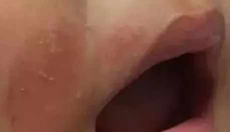 宝宝被口水呛着了怎么办,宝宝被口水呛得脸通红