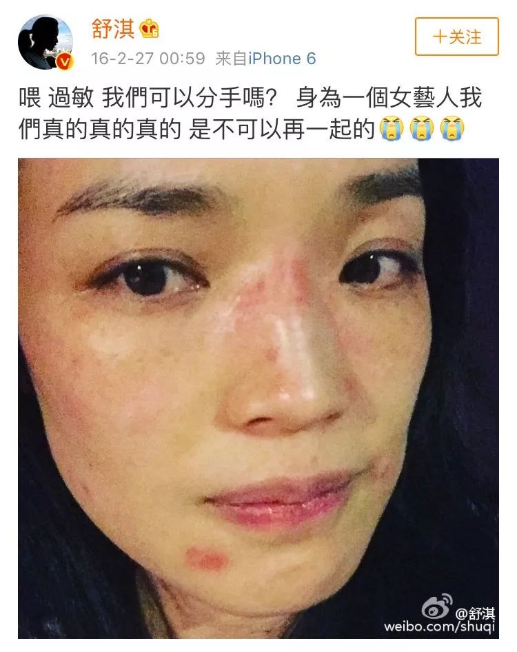 欧阳娜娜水光肌面膜,欧阳娜娜面膜水光肌