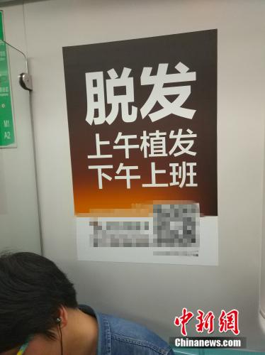 脱发青年养发生发过程分享,脱发人的自白