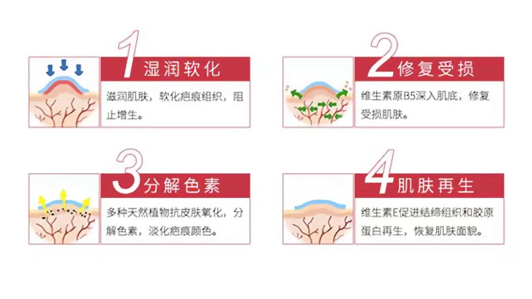 疤痕体质如何去痘印和烫伤印,烫伤色素疤痕修复的最新方法